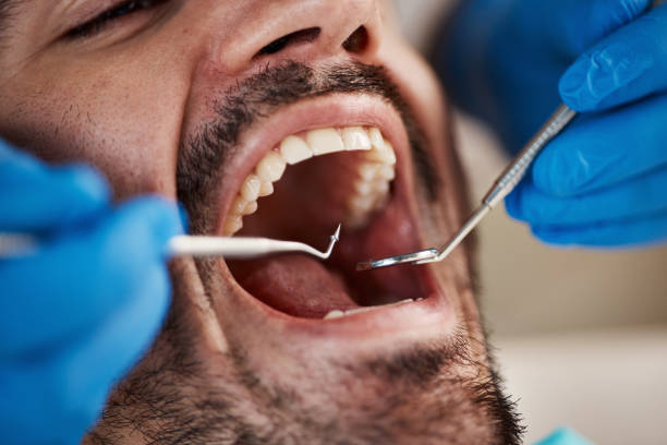 Best Knocked-Out Tooth Emergency  in Rockledge, FL